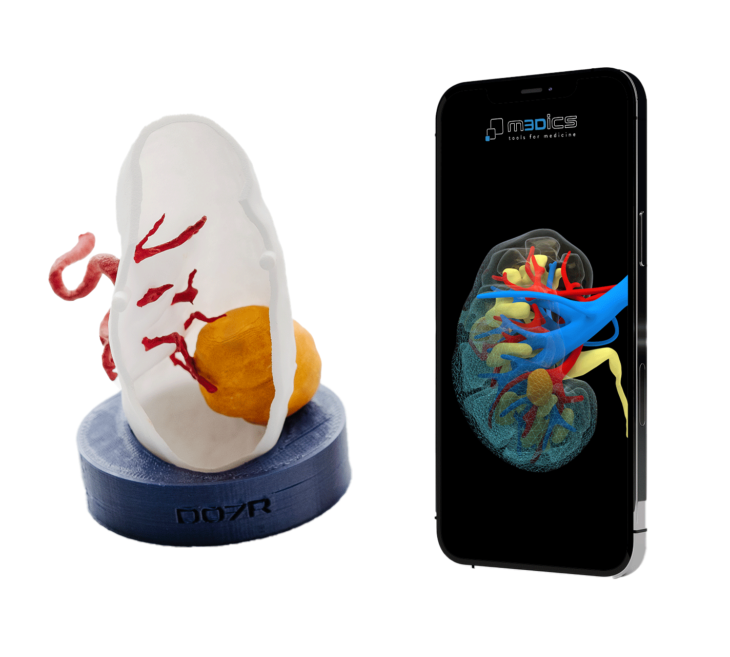 Interactive patient-specific anatomical model